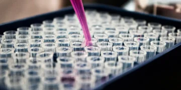 Inflamação no cérebro pode ser peça central no Alzheimer, aponta estudo